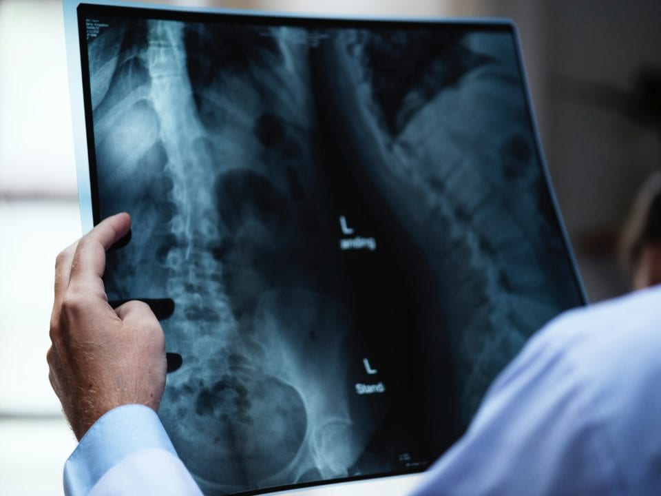 Röntgen-Bild-Beitrag-keine-Diagnose